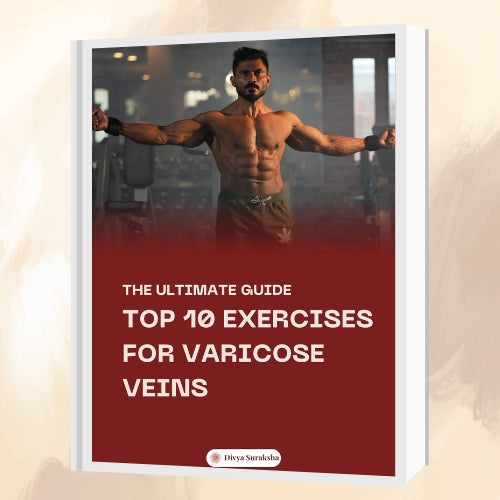 eBook: Top 10 Exercises for Varicose Veins